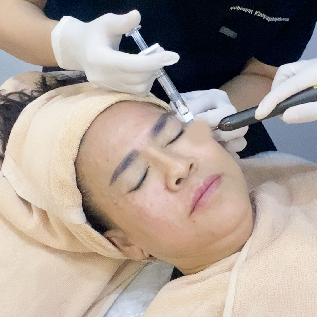 ข้อปฏิบัติตัวหลังฉีด Skin Booster